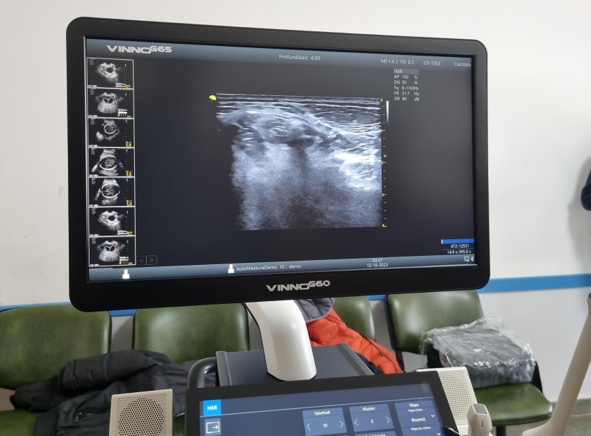 Donaron al Hospital un Ecgrafo Doppler color multipropsito de ltima