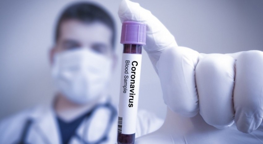 coronavirus