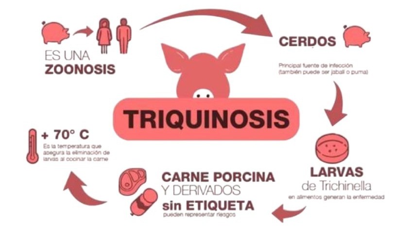 Triquinosis